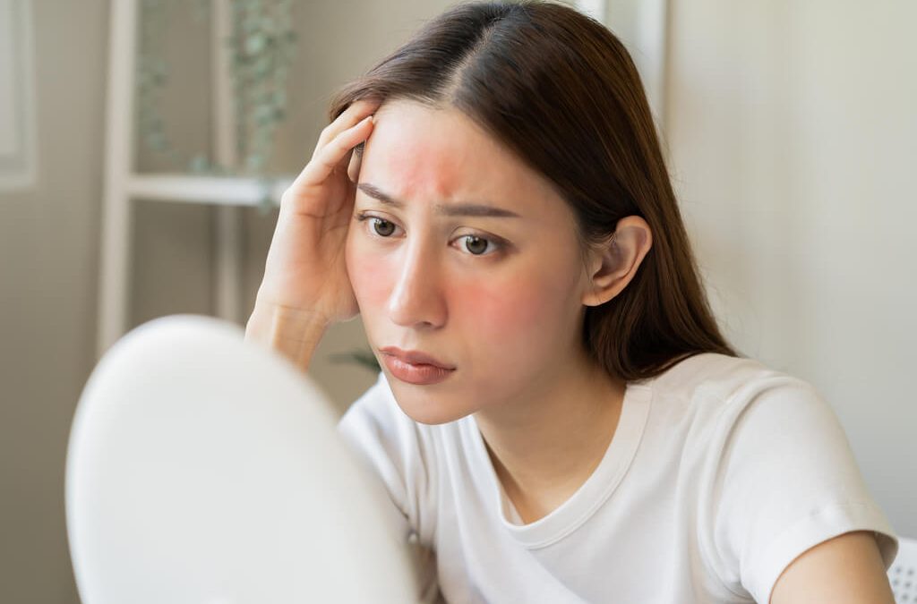 Crvenilo i ljuštenje kože na licu: uzroci, simptomi i tretmani