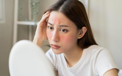 Crvenilo i ljuštenje kože na licu: uzroci, simptomi i tretmani
